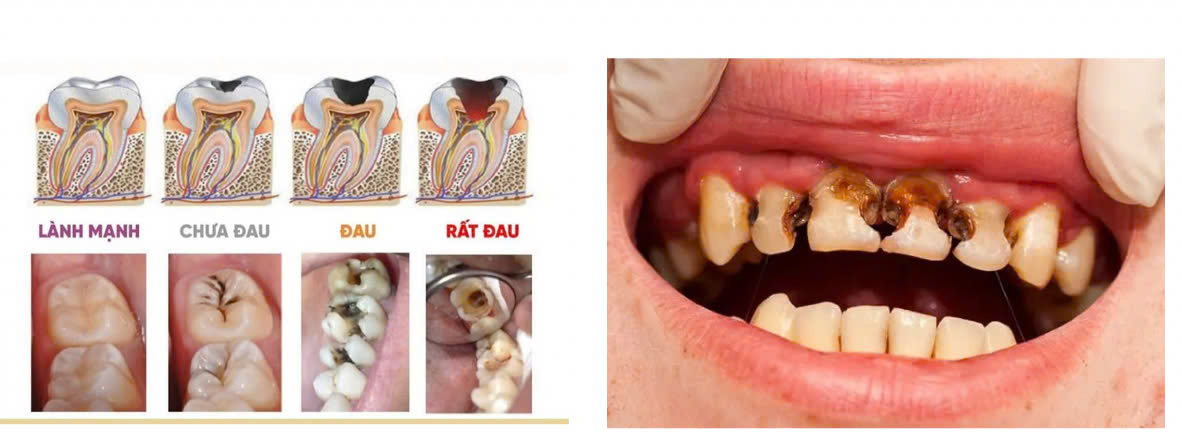 Faf712cd9bac20f279bd