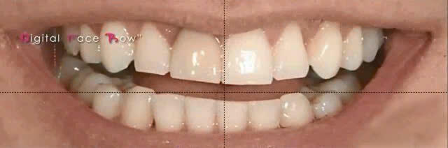 Z6142018731673_f181af792786426cb89ebd52a7b22056 Nha Khoa Chia Sẻ
