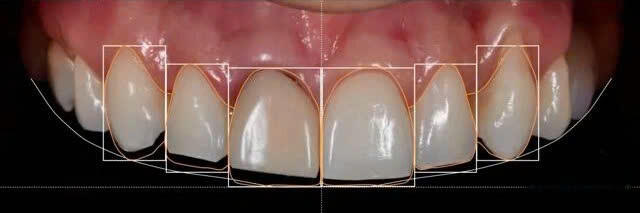 Z6142020507989_889cdf66427f432a33c477becc1365f6 Nha Khoa Chia Sẻ