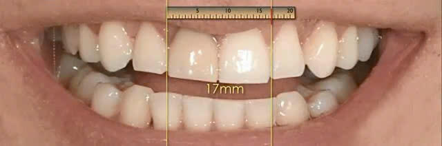 Z6142021346774_56af3c1d34d5dc9fe5672f22fcc77edf Nha Khoa Chia Sẻ