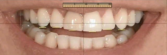 Z6142021690370_4bd45affbacae0582087dda0d03a1986 Nha Khoa Chia Sẻ